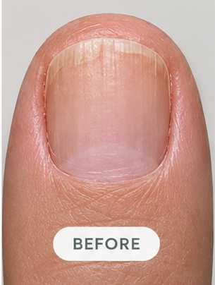 A nail before the routine, month 6